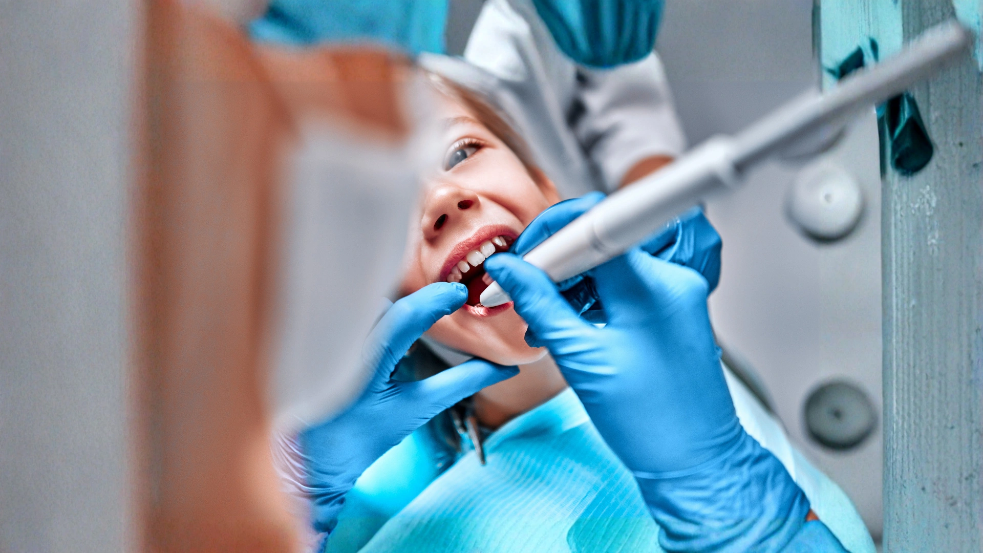 dental bonding (1)