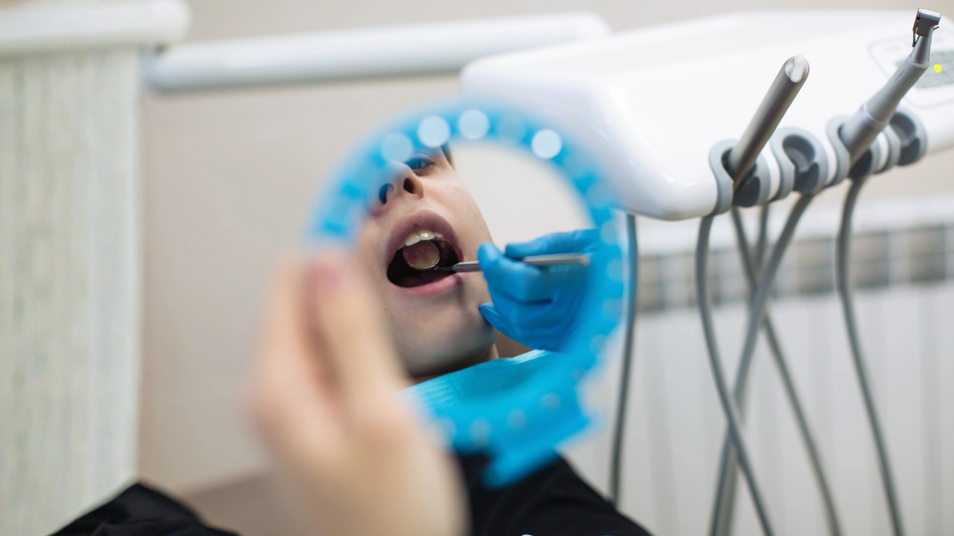dental filling