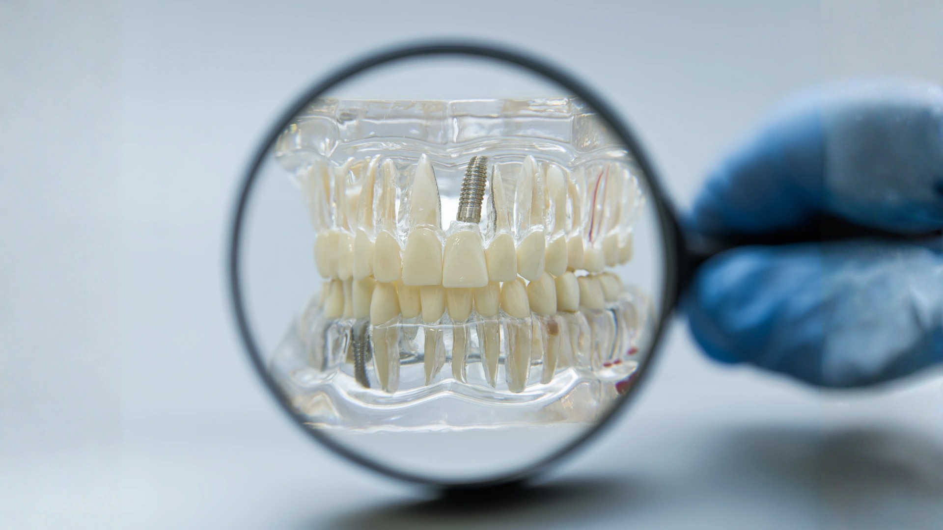 implant
