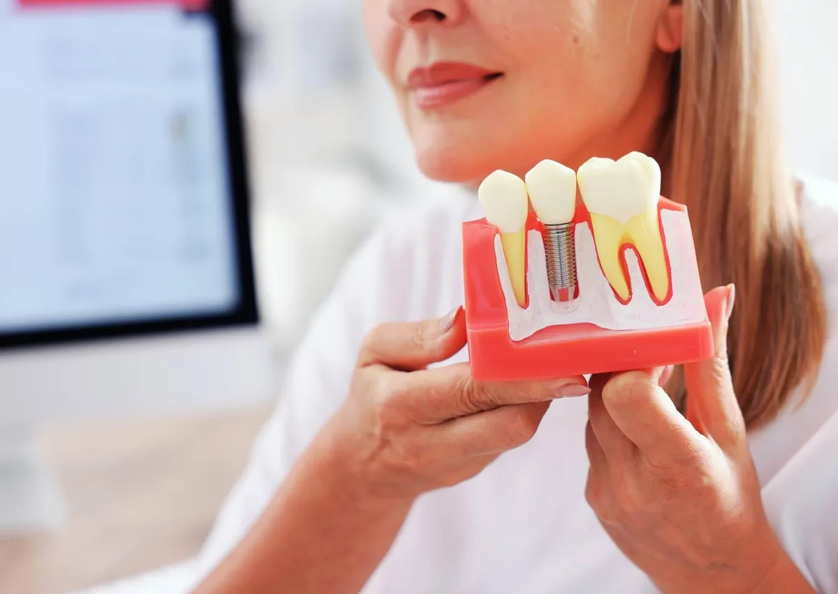 Dental professional holding a model of a dental implant while discussing affordable dental implant treatment options.