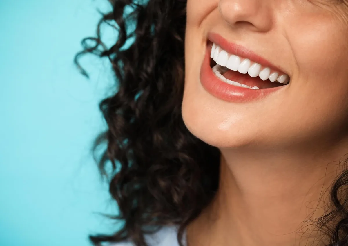 Close-up of a bright, even smile illustrating the long-term cosmetic appearance of dental veneers.
